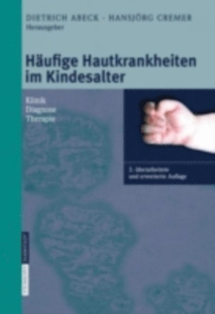 H. Cremer, D. Abeck - Häufige Hautkrankheiten im Kindesalter, E-bok