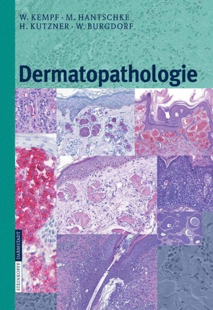 W. Burgdorf, H. Kutzner, Markus Hantschke, W. Kempf - Dermatopathologie, E-bok