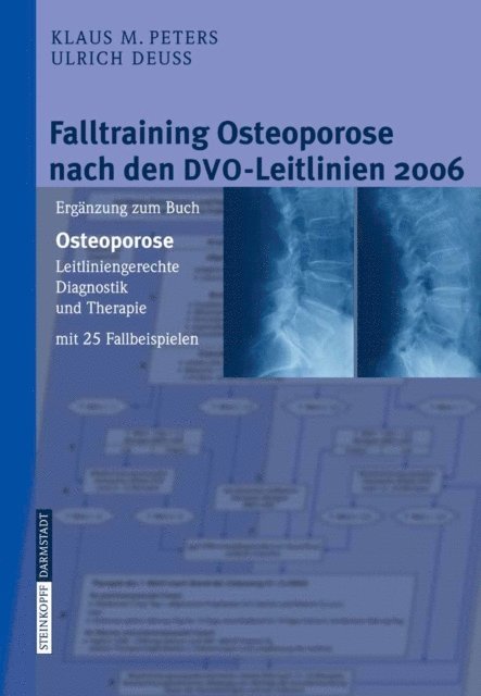 Ulrich Deu, Klaus M. Peters - Falltraining Osteoporose nach den DVO-Leitlinien 2006, E-bok