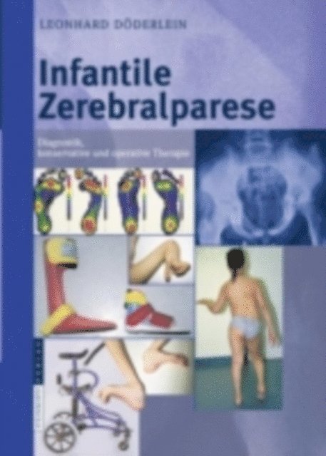 L. Doderlein - Infantile Zerebralparese, E-bok