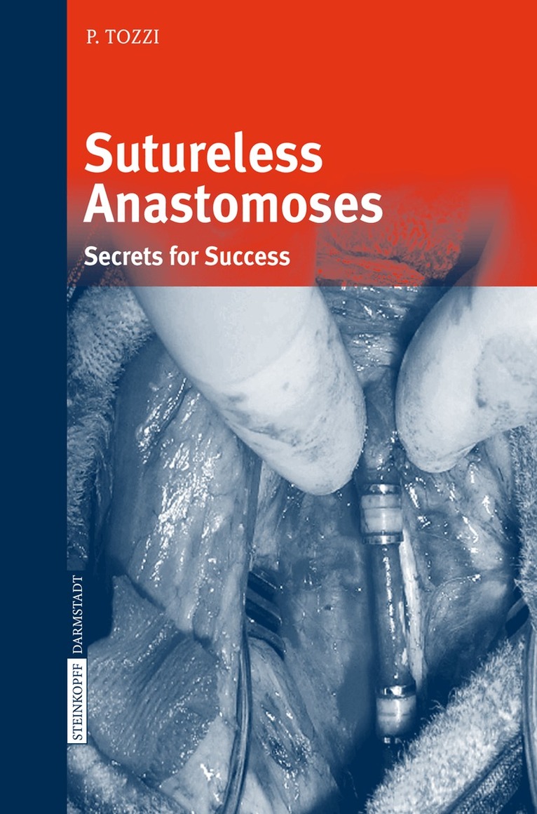 Piergiorgio Tozzi - Sutureless Anastomoses, Inbunden. Tillgänglighet: Lägg i varukorg