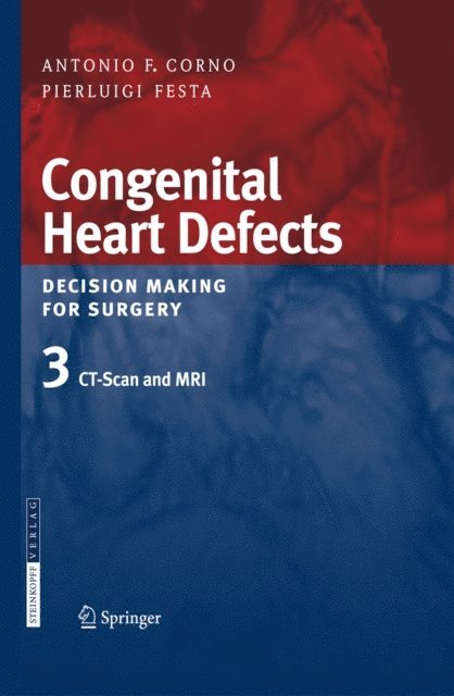 Pierluigi Festa, Antonio F. Corno - Congenital Heart Defects. Decision Making for Surgery, E-bok. Tillgänglighet: Lägg i varukorg