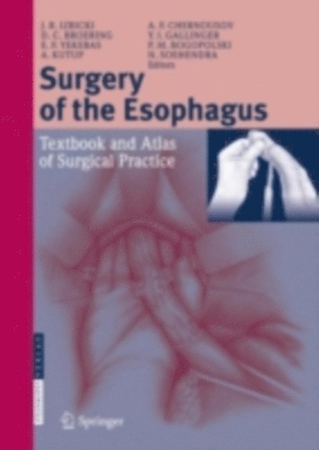 Nib Sohendra, Asad Kutup, Pavel M. Bogopolski, Emre F. Yekebas, Yuri I. Gallinger, Dieter Broering, Alexander F. Chernousov, Jakob R. Izbicki - Surgery of the Esophagus, E-bok