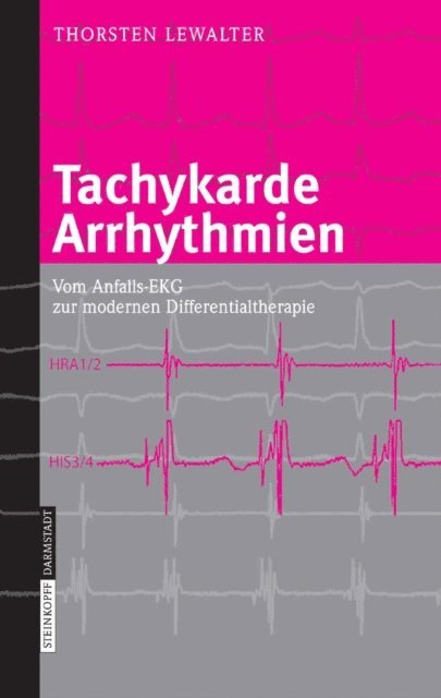 Thorsten Lewalter - Tachykarde Arrhythmien, E-bok