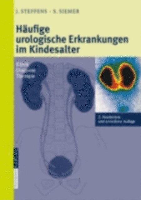Stefan Siemer, Joachim Steffens, Stefan Siemer, Joachim Steffens - Häufige urologische Erkrankungen im Kindesalter, E-bok
