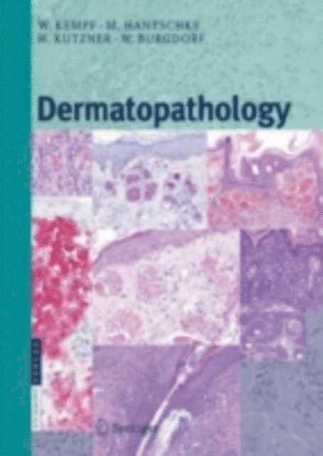 Walter H.C. Burgdorf, Heinz Kutzner, Markus Hantschke, Werner Kempf - Dermatopathology, E-bok