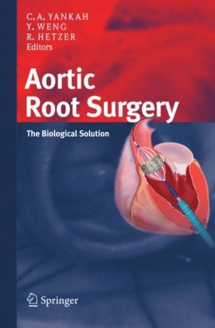 Roland Hetzer, Yu-Guo Weng, Charles Abraham Yankah - Aortic Root Surgery, E-bok