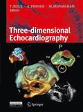 3D-echocardiography
