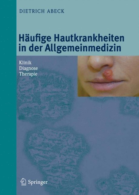 Dietrich Abeck - Häufige Hautkrankheiten in der Allgemeinmedizin, E-bok