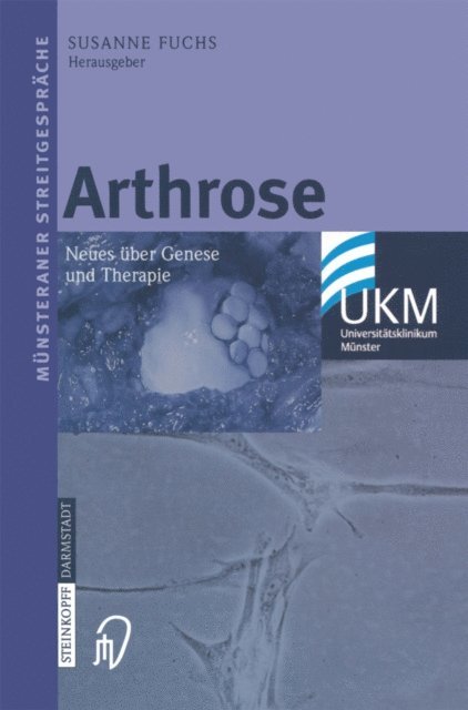 Susanne Fuchs - Arthrose, E-bok