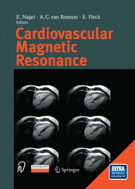 E. Fleck, A.C. van Rossum, E. Nagel - Cardiovascular Magnetic Resonance, E-bok