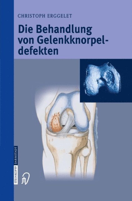 Christoph Erggelet - Die Behandlung von Gelenkknorpeldefekten, E-bok