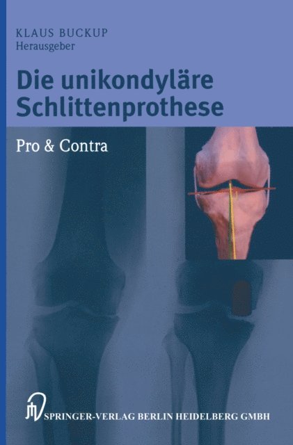 Klaus Buckup - Die unikondyläre Schlittenprothese Pro & Contra, E-bok