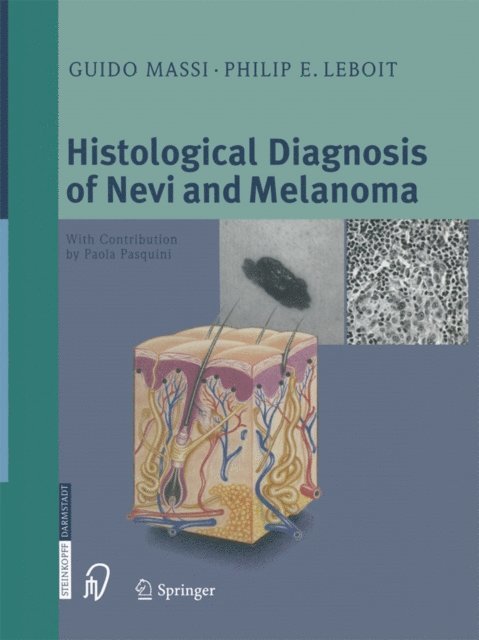 Philip E. LeBoit, Guido Massi - Histological Diagnosis of Nevi and Melanoma, E-bok