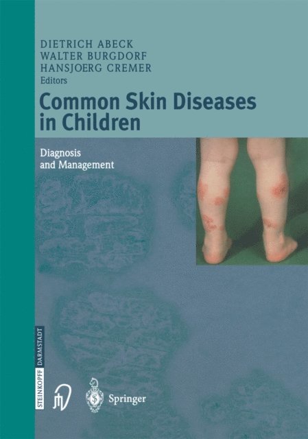 Hansjoerg Cremer, Walter Burgdorf, Dietrich Abeck - Common Skin Diseases in Children, E-bok