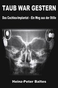 TAUB WAR GESTERN