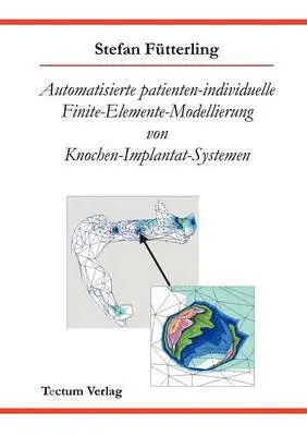 Stefan Fütterling - Automatisierte patienten-individuelle Finite-Elemente-Modellierung von Knochen-Implantat-Systemen, Häftad. Tillgänglighet: Lägg i varukorg