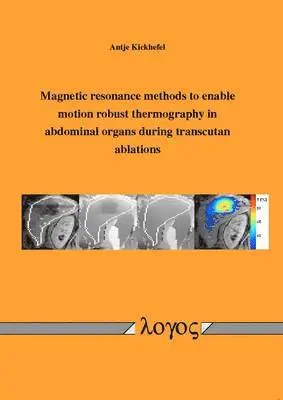 Antje Kickhefel - Magnetic Resonance Methods to Enable Motion Robust Thermography in Abdominal Organs During Transcutan Ablations, Häftad. Tillgänglighet: Lägg i varukorg