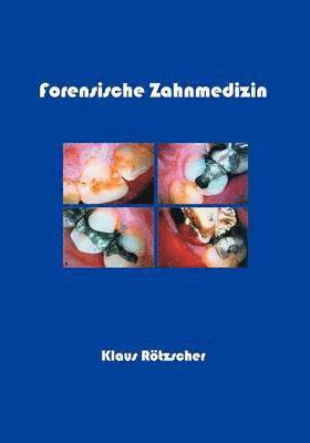 Klaus Rötzscher - Forensische Zahnmedizin, Häftad. Tillgänglighet: Lägg i varukorg