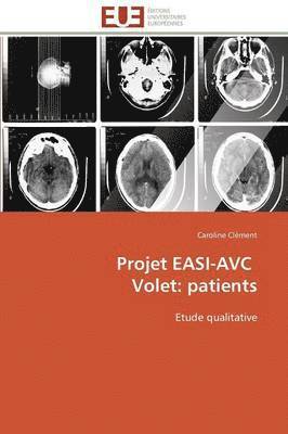 Clement-C - Projet easi-avc volet, Häftad