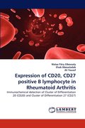 Expression of CD20, CD27 positive B lymphocyte in Rheumatoid Arthritis
