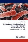 Tooth Root Conditioning- A Scanning Electron Microscope Study