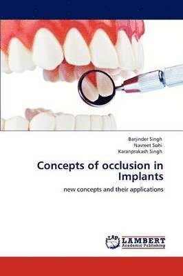 Barjinder Singh, Navreet Sohi, Karanprakash Singh - Concepts of occlusion in Implants, Häftad