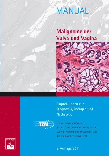 Rainer Kurzl, Martin Kolben, Christian Dannecker - Malignome der Vulva und Vagina, E-bok