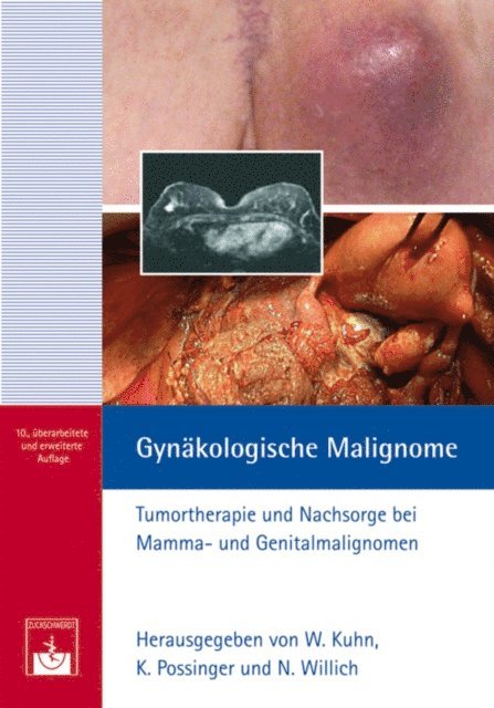 Normann Willich, Kurt Possinger, Walther Kuhn - Gynäkologische Malignome, E-bok