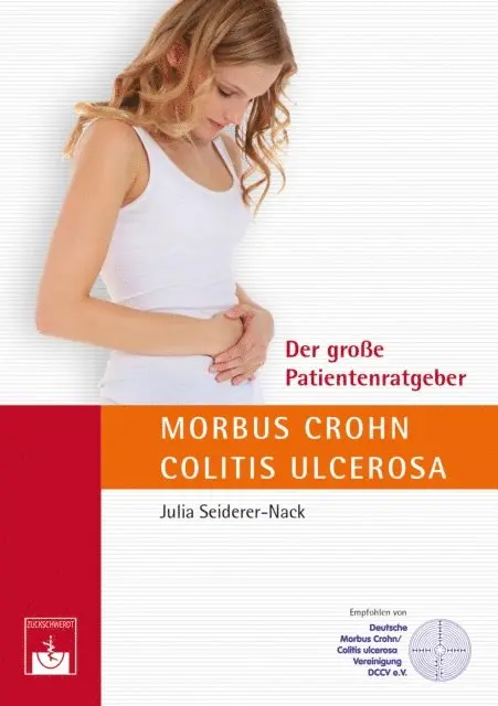 J. Seiderer-Nack - Der große Patientenratgeber Morbus Crohn und Colitis ulcerosa, E-bok. Tillgänglighet: Lägg i varukorg