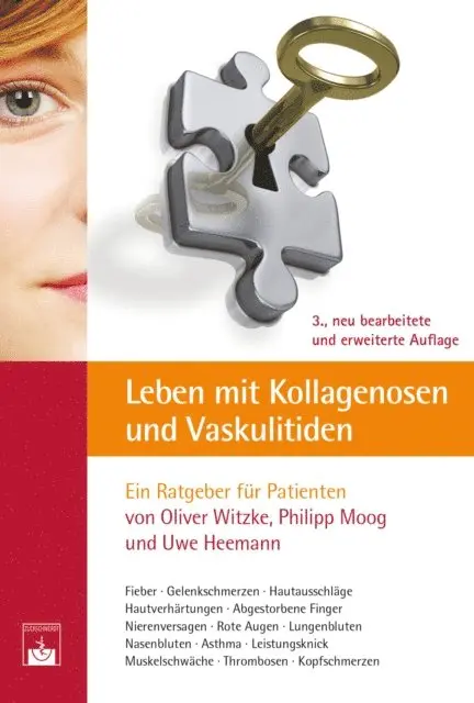 Uwe Heemann, Philipp Moog, Oliver Witzke - Leben mit Kollagenosen und Vaskulitiden, E-bok. Tillgänglighet: Lägg i varukorg