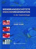 MembrangeschÃ¼tzte Knochenregeneration in der Implantologie