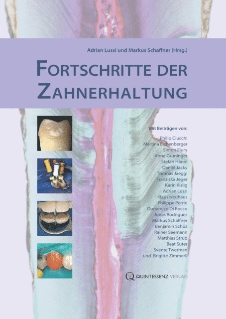 Markus Schaffner, Adrian Lussi - Fortschritte der Zahnerhaltung, E-bok