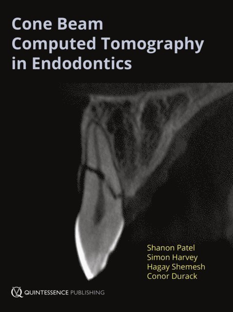 Conor Durack, Hagay Shemesh, Simon Harvey, Shanon Patel - Cone Beam Computed Tomography in Endodontics, E-bok