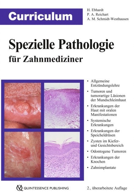 Andrea Maria Schmidt-Westhausen, Peter A. Reichart, Harald Ebhardt - Curriculum Spezielle Pathologie für Zahnmediziner, E-bok