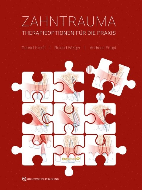 Andreas Filippi, Roland Weiger, Gabriel Krastl - Zahntrauma, E-bok