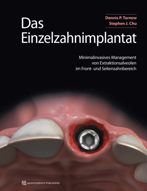 Stephen J. Chu, Dennis P. Tarnow - Das Einzelzahnimplantat, E-bok