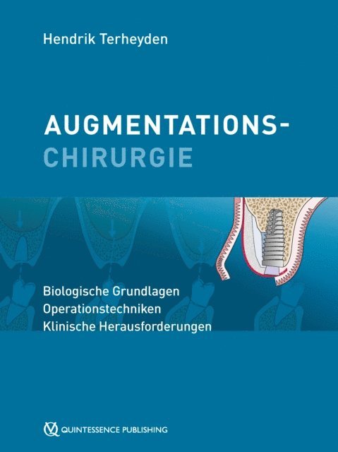 Hendrik Terheyden - Augmentationschirurgie, E-bok