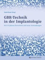 Daniel Buser - GBR-Technik in der Implantologie, Inbunden