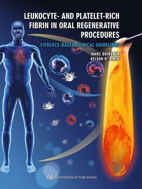 Nelson R. Pinto, Marc Quirynen - Leukocyte- and Platelet-Rich Fibrin in Oral Regenerative Procedures, E-bok