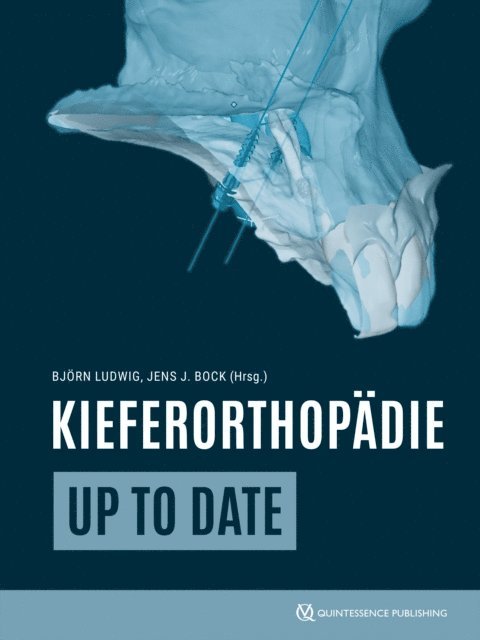 Jens Johannes Bock, Bjorn Ludwig - Kieferorthopädie up to date, E-bok
