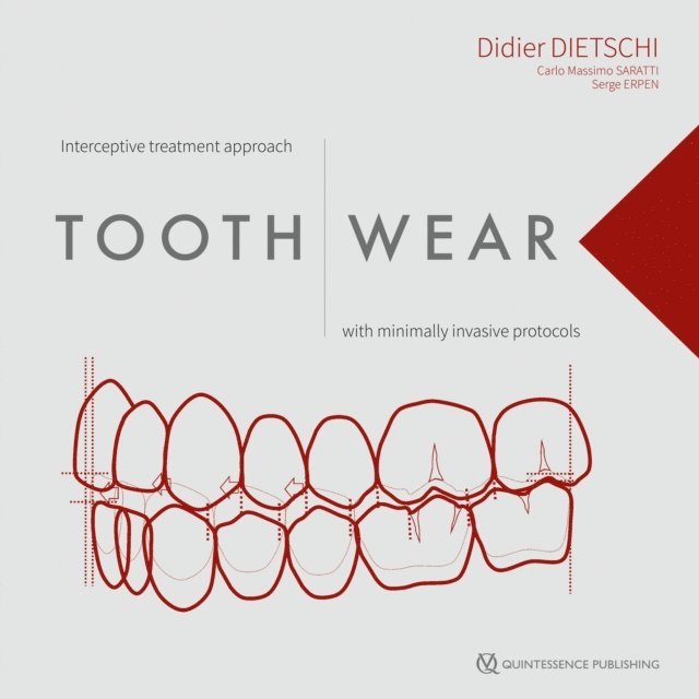 Serge Erpen, Carlo Massimo Saratti, Didier Dietschi - Tooth Wear, E-bok