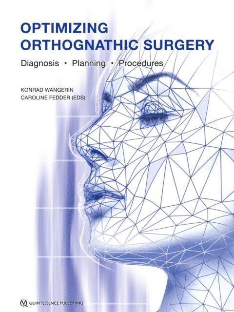 Konrad Wangerin, Caroline Fedder - Optimizing Orthognathic Surgery, E-bok