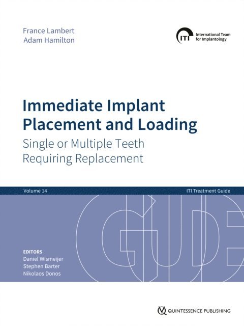 Adam Hamilton, France Lambert, Nikolaos Donos, Stephen Barter, Daniel Wismeijer - Immediate Implant Placement and Loading - Single or Multiple Teeth Requiring Replacement, E-bok