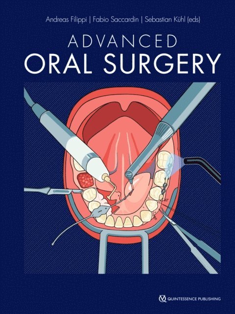 Sebastian Kuhl, Fabio Saccardin, Andreas Filippi - Advanced Oral Surgery, E-bok