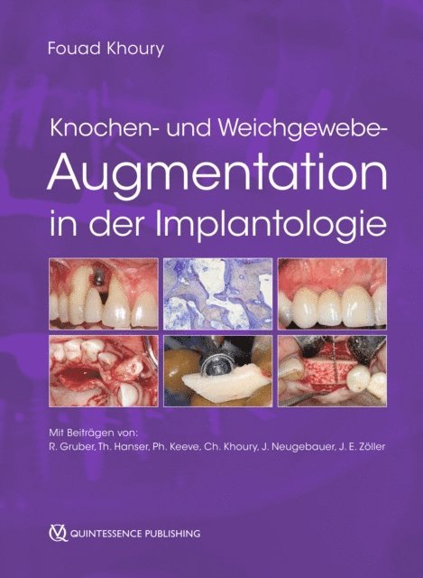 Fouad Khoury - Knochen- und Weichgewebeaugmentation in der Implantologie, E-bok