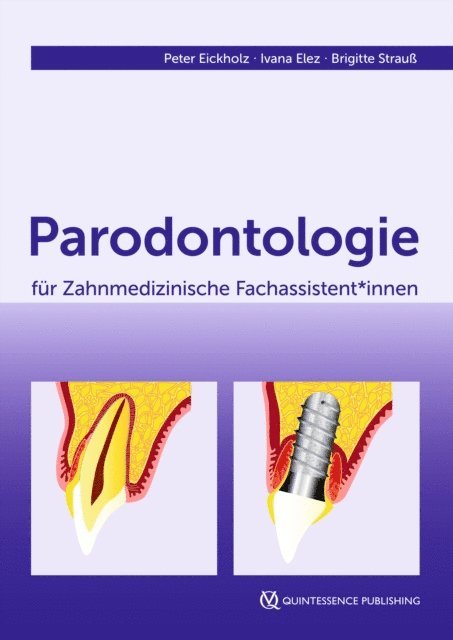 Brigitte Strau, Ivana Elez, Peter Eickholz - Parodontologie für Zahnmedizinische Fachassistent*innen, E-bok