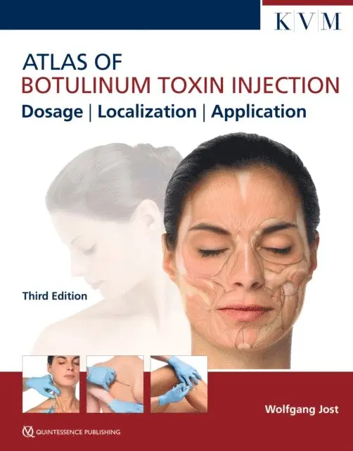Wolfgang Jost - Atlas of Botulinum Toxin Injection, E-bok. Tillgänglighet: Lägg i varukorg