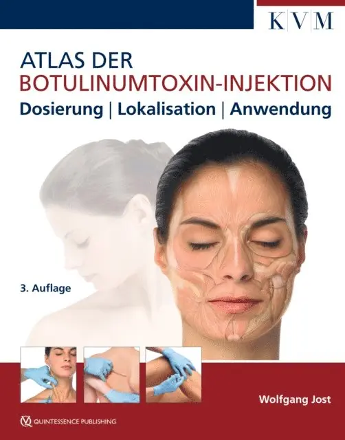 Wolfgang Jost - Atlas der Botulinumtoxin-Injektion, E-bok. Tillgänglighet: Lägg i varukorg