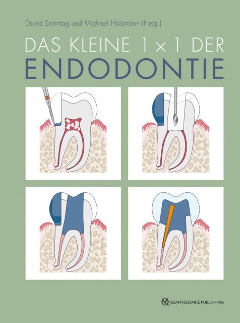 Michael Hulsmann, David Sonntag - Das kleine 1x1 der Endodontie, E-bok